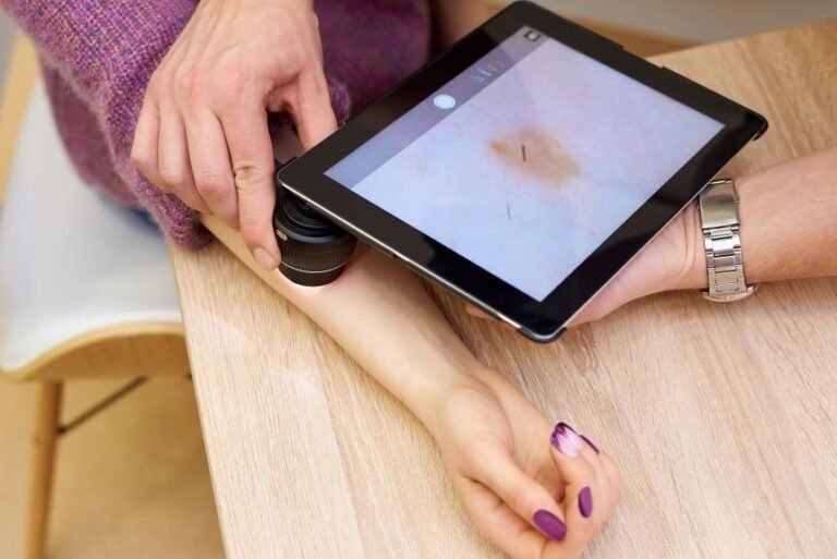 Exame dermatoscópico realizado com um tablet
